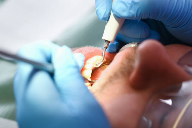 Best Mobile Emergency Dentist in Granite Quarry, NC