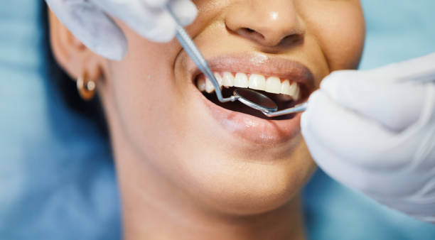 Best Broken or Cracked Tooth Emergency Dentist in Granite Quarry, NC