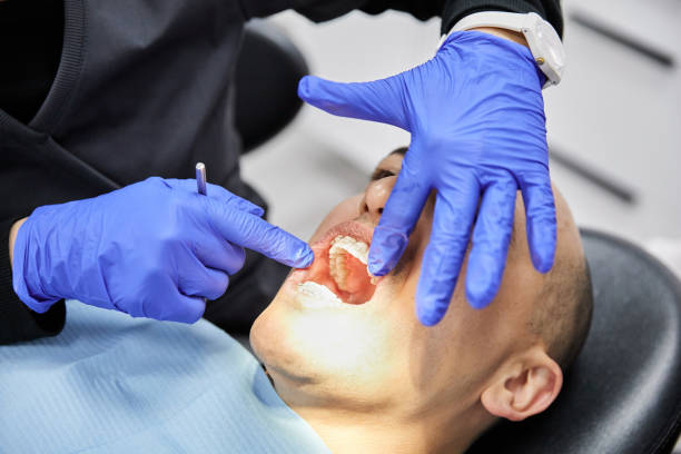 Best Emergency Dental Extractions in Granite Quarry, NC